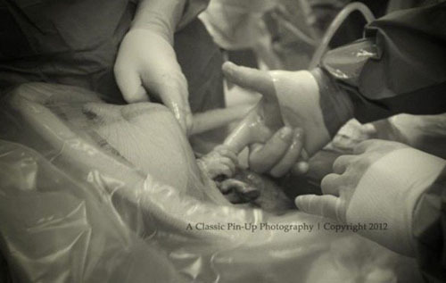 Hình ảnh bất ngờ của thai nhi nắm tay bác sĩ khi vẫn nằm trong bụng mẹ