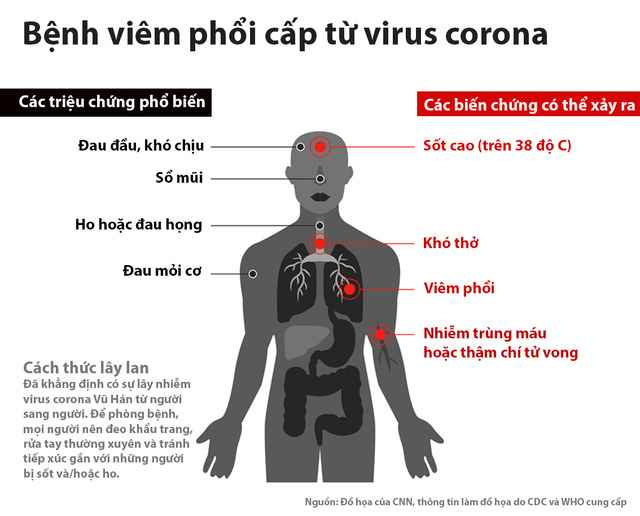 Đặc điểm của bệnh viêm phổi cấp từ virus corona